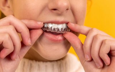 Invisalign Boston: Are Clear Aligners Safe to Use?
