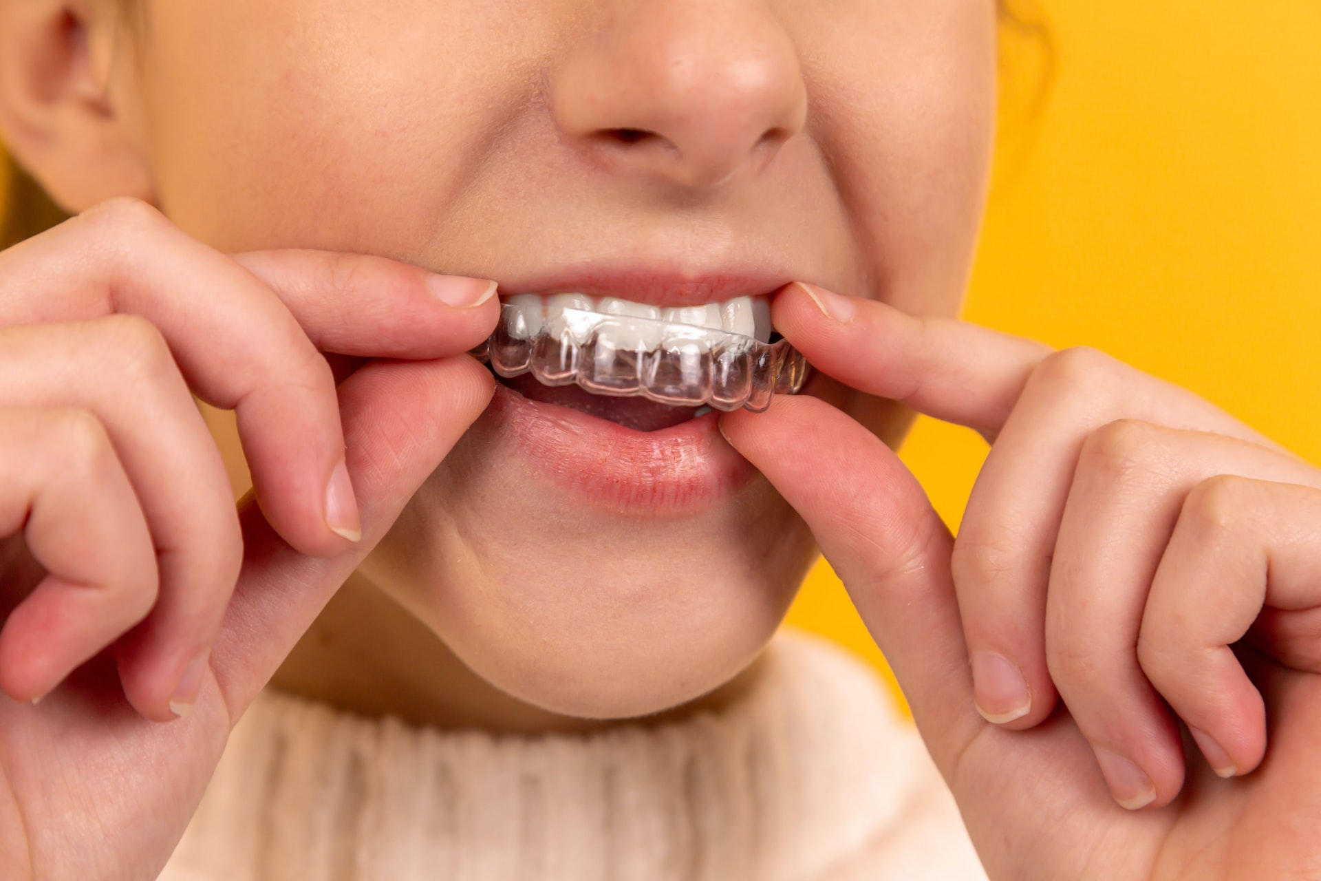 Invisalign Boston: Are Clear Aligners Safe to Use?