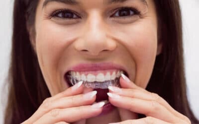 Where to Find Invisalign in Plymouth for the Best Treatment