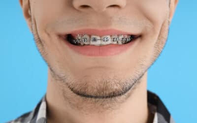 All 6 Types of Orthodontic Treatments | Orthodontist Plymouth MA
