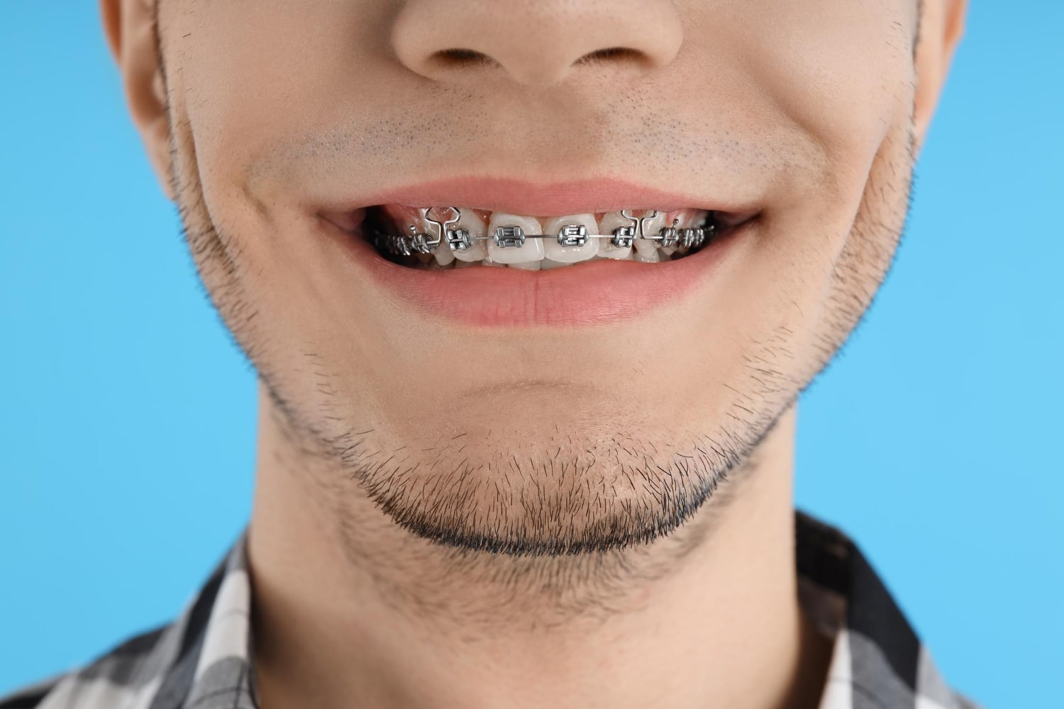 orthodontist Plymouth